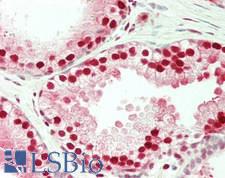 FKBP5 / FKBP51 Antibody - Human Prostate: Formalin-Fixed, Paraffin-Embedded (FFPE)