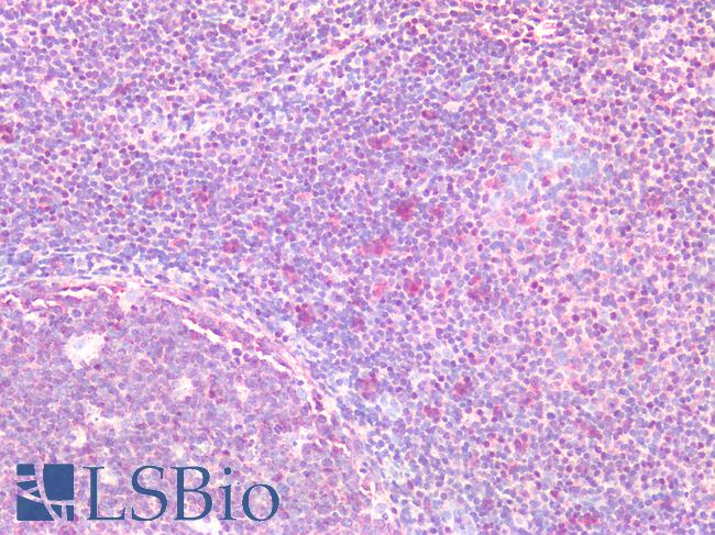 FKBPL Antibody - Human Tonsil: Formalin-Fixed, Paraffin-Embedded (FFPE)