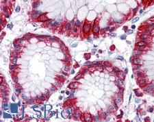 FKSG89 / MBOAT4 Antibody - Anti-MBOAT4 antibody IHC of human stomach. Immunohistochemistry of formalin-fixed, paraffin-embedded tissue after heat-induced antigen retrieval.