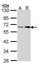 FKTN / Fukutin Antibody - Sample (30 ug of whole cell lysate). A: H1299. B: Hela. 10% SDS PAGE. FKTN antibody diluted at 1:1000. 