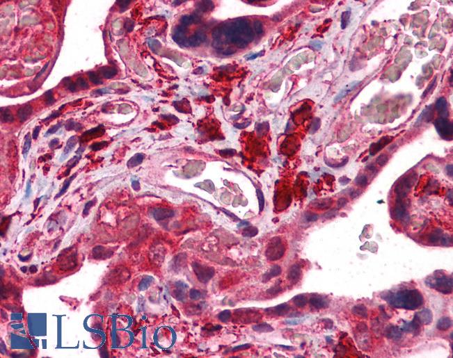 FKTN / Fukutin Antibody - Anti-FKTN / Fukutin antibody IHC of human placenta. Immunohistochemistry of formalin-fixed, paraffin-embedded tissue after heat-induced antigen retrieval. Antibody concentration 10 ug/ml.