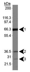 FLCN / Folliculin Antibody - FLCN Antibody - Western blot of FLCN isoforms 1, 2 and 3 on HeLa whole cell lysate.