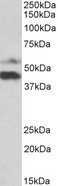 FLJ22028 Antibody - PYROXD1 antibody (1 ug/ml) staining of Human Colorectal cancer lysate (35 ug protein in RIPA buffer). Primary incubation was 1 hour. Detected by chemiluminescence.