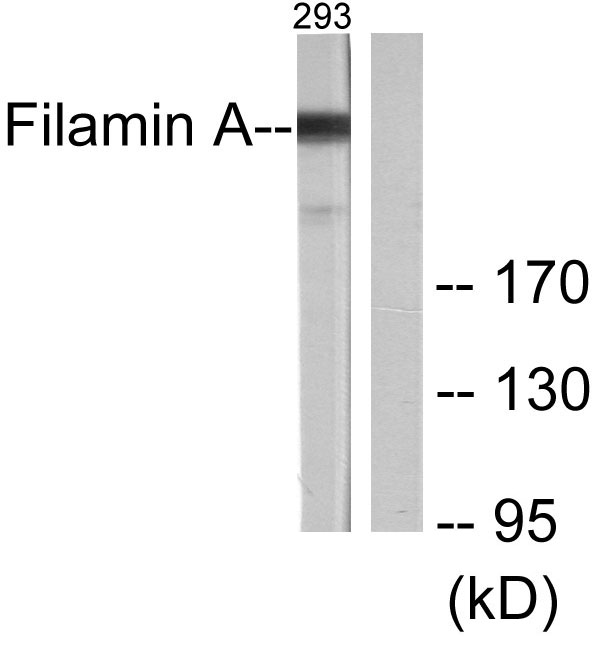 FLNA / Filamin A Antibody - Western blot analysis of lysates from 293 cells, treated with EGF 200ng/ml 5', using Filamin A Antibody. The lane on the right is blocked with the synthesized peptide.