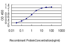 FLNA / Filamin A Antibody - Detection limit for recombinant GST tagged FLNA is approximately 0.03 ng/ml as a capture antibody.