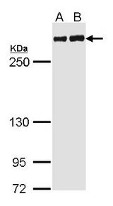 FLNA / Filamin A Antibody - Sample (30 ug of whole cell lysate). A: H1299. B: Hep G2. 5% SDS PAGE. FLNA antibody diluted at 1:1000. 