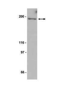 FLT1 / VEGFR1 Antibody - WB: HUVEC membrane cell lysate was probed with anti-Flt-1 (2g/ml).