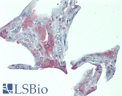 FLT3LG / Flt3 Ligand Antibody - Human Lung: Formalin-Fixed, Paraffin-Embedded (FFPE), at a concentration of 10 ug/ml. 