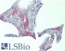 FLT3LG / Flt3 Ligand Antibody - Human Lung: Formalin-Fixed, Paraffin-Embedded (FFPE), at a concentration of 10 ug/ml. 
