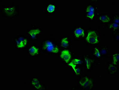 FLT3LG / Flt3 Ligand Antibody - Immunofluorescence staining of MCF-7 cells with FLT3LG Antibody at 1:266, counter-stained with DAPI. The cells were fixed in 4% formaldehyde, permeabilized using 0.2% Triton X-100 and blocked in 10% normal Goat Serum. The cells were then incubated with the antibody overnight at 4°C. The secondary antibody was Alexa Fluor 488-congugated AffiniPure Goat Anti-Rabbit IgG(H+L).
