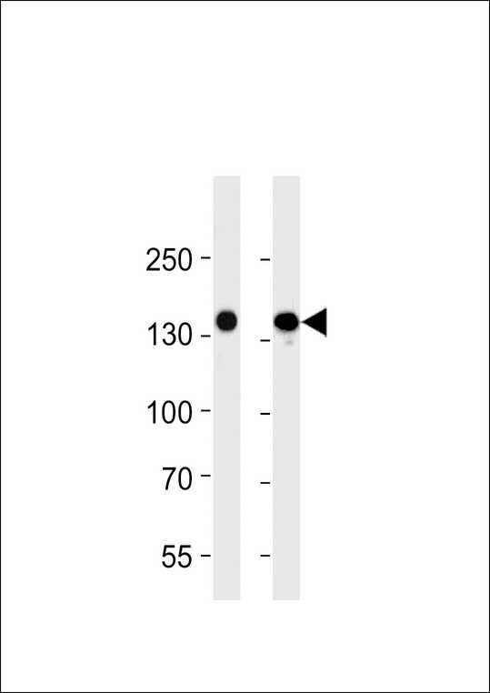 FLT4 / VEGFR3 Antibody - VEGFR3 Antibody western blot of 293 and A549 cell line lysates (35 ug/lane). The VEGFR3 antibody detected the VEGFR3 protein (arrow).