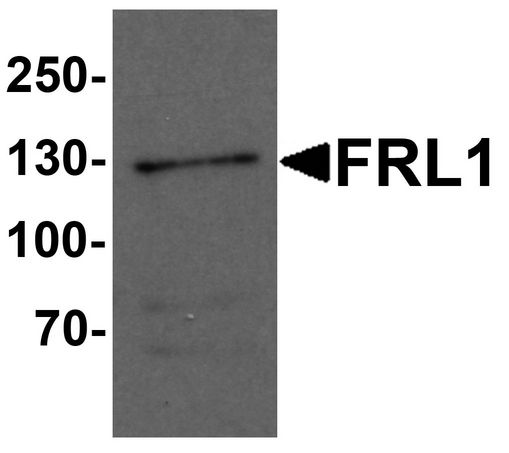 FMNL1 Antibody - Western blot analysis of FRL1 in EL4 cell lysate with FRL1 antibody at 1 ug/ml.