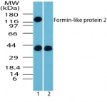 FMNL2 Antibody - Western blot of Formin-like protein 2 in whole mouse embryo body tissue lysate in the 1) absence and 2) presence of immunizing peptide using antibody at 2 ug/ml.
