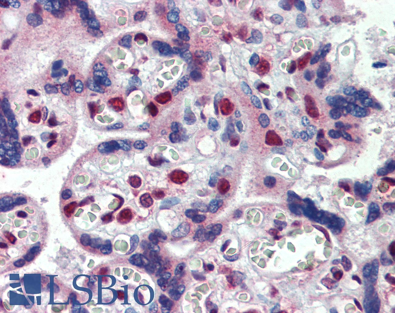 FMR1 / FMRP Antibody - Anti-FMR1 antibody IHC of human placenta. Immunohistochemistry of formalin-fixed, paraffin-embedded tissue after heat-induced antigen retrieval. Antibody concentration 2.5 ug/ml.