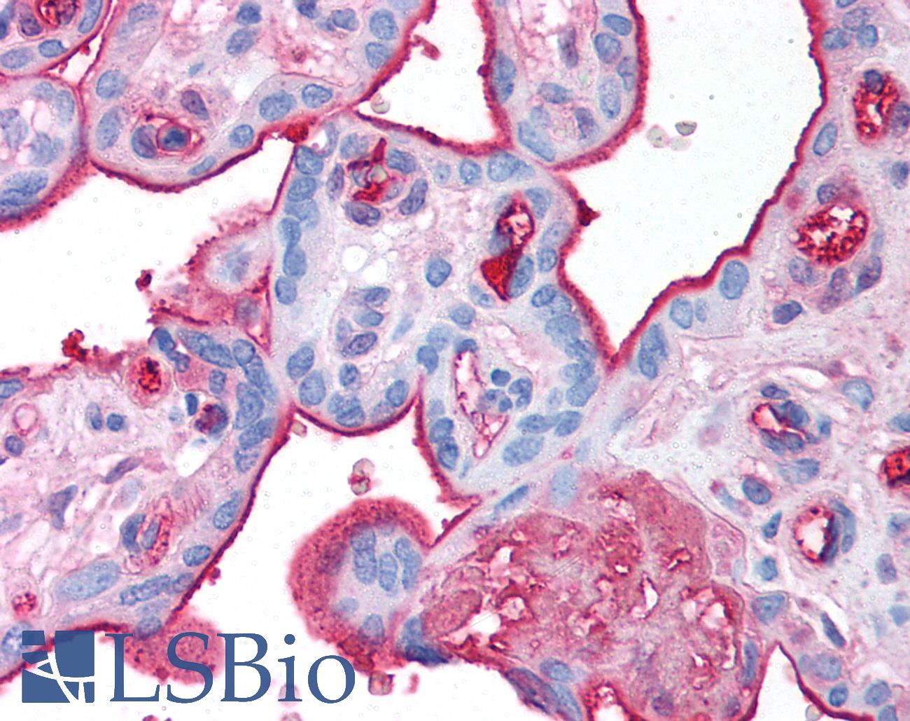 FN1 / Fibronectin Antibody - Placenta: Formalin-Fixed Paraffin Embedded (FFPE)