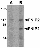 FNIP2 Antibody - Western blot of FNIP2 in rat skeletal muscle lysate with FNIP2 antibody at (A) 1 and (B) 2 ug/ml.