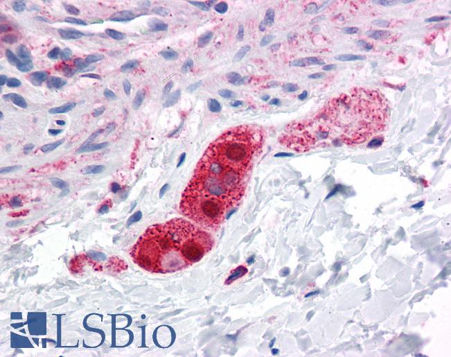 FNIP2 Antibody - Anti-FNIP2 antibody IHC of human colon, submucosal plexus. Immunohistochemistry of formalin-fixed, paraffin-embedded tissue after heat-induced antigen retrieval. Antibody concentration 5 ug/ml.