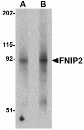 FNIP2 Antibody - Western blot of FNIP2 in mouse skeletal muscle lysate with FNIP2 antibody at (A) 1 and (B) 2 ug/ml.