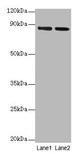 FOLH1 / PSMA Antibody - Western blot All lanes: Glutamate carboxypeptidase 2 antibody at 2µg/ml Lane 1: U251 whole cell lysate Lane 2: PC-3 whole cell lysate Secondary Goat polyclonal to rabbit IgG at 1/10000 dilution Predicted band size: 85, 13, 10, 79, 83, 81, 51 kDa Observed band size: 81 kDa
