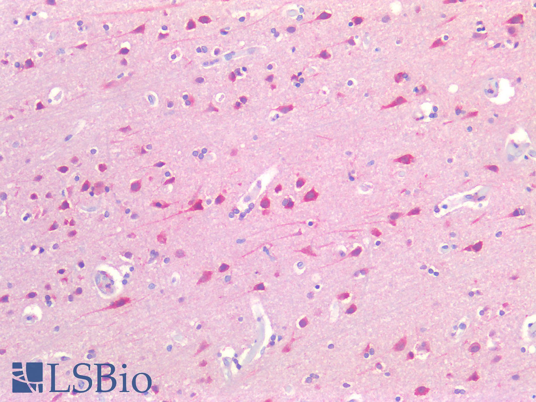 FOLH1 / PSMA Antibody - Human Brain, Cortex: Formalin-Fixed, Paraffin-Embedded (FFPE)