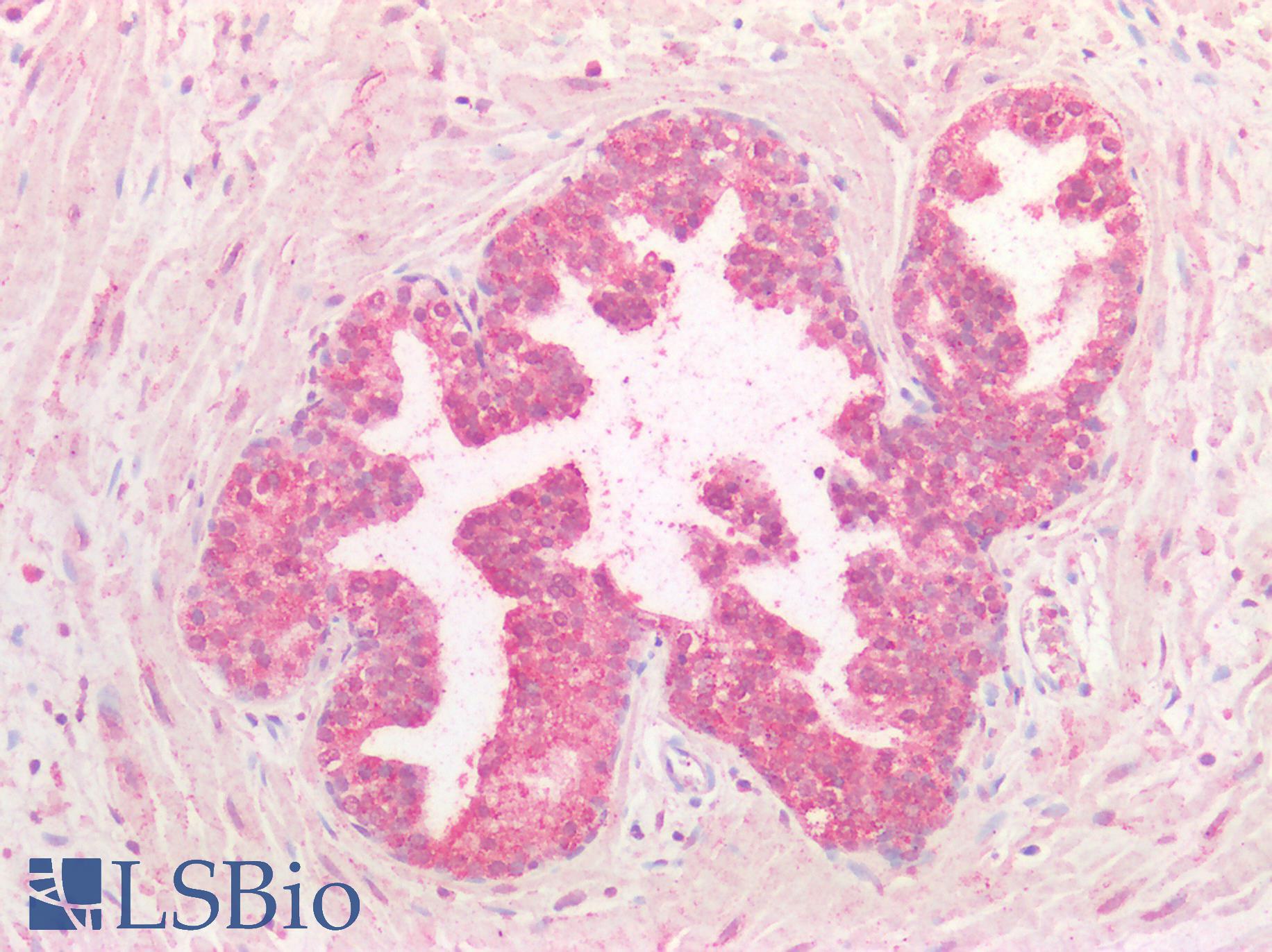 FOLR1 / Folate Receptor Alpha Antibody - Human Prostate: Formalin-Fixed, Paraffin-Embedded (FFPE)