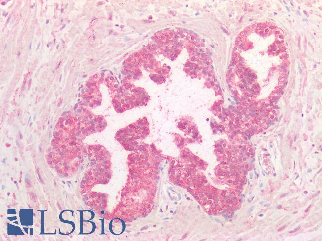 FOLR1 / Folate Receptor Alpha Antibody - Human Prostate: Formalin-Fixed, Paraffin-Embedded (FFPE)