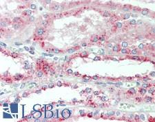 FOLR3 Antibody - Human Kidney: Formalin-Fixed, Paraffin-Embedded (FFPE)