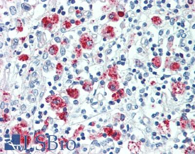 FOLR3 Antibody - Human Thymus: Formalin-Fixed, Paraffin-Embedded (FFPE)