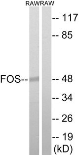 FOS / c-FOS Antibody - Western blot analysis of lysates from RAW264.7 cells, using FOS Antibody. The lane on the right is blocked with the synthesized peptide.