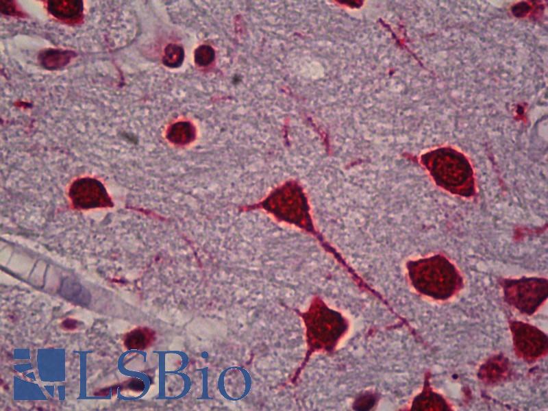 FOS / c-FOS Antibody - Anti-FOS / c-FOS antibody IHC of human brain, cortex. Immunohistochemistry of formalin-fixed, paraffin-embedded tissue after heat-induced antigen retrieval. Antibody concentration 5 ug/ml.