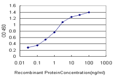 FOXA1 Antibody - Detection limit for recombinant GST tagged FOXA1 is approximately 0.03 ng/ml as a capture antibody.