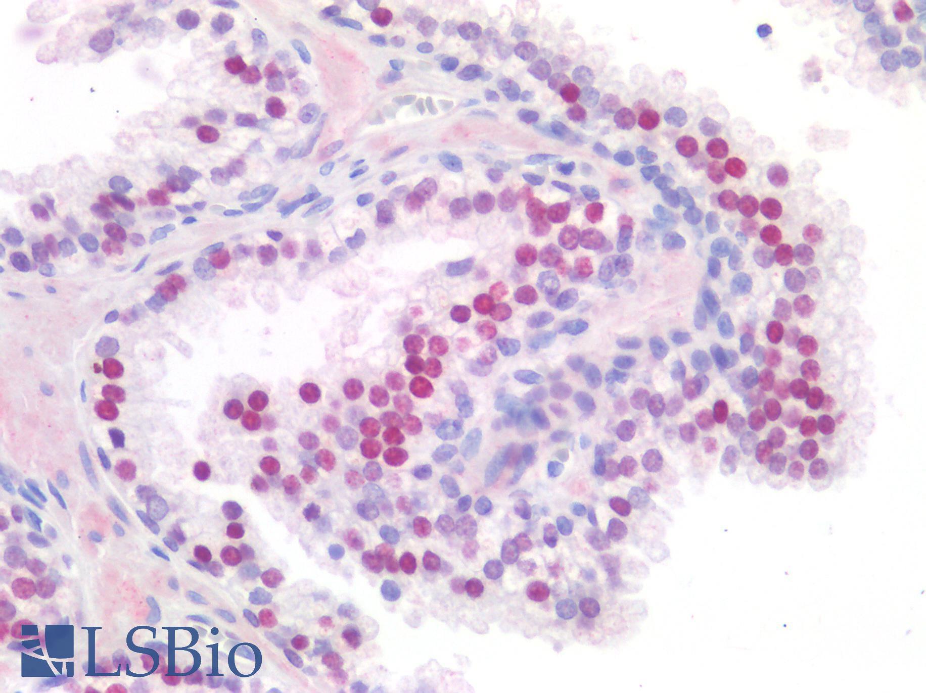 FOXA1 Antibody - Human Prostate: Formalin-Fixed, Paraffin-Embedded (FFPE)