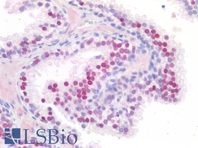 FOXA1 Antibody - Human Prostate: Formalin-Fixed, Paraffin-Embedded (FFPE)