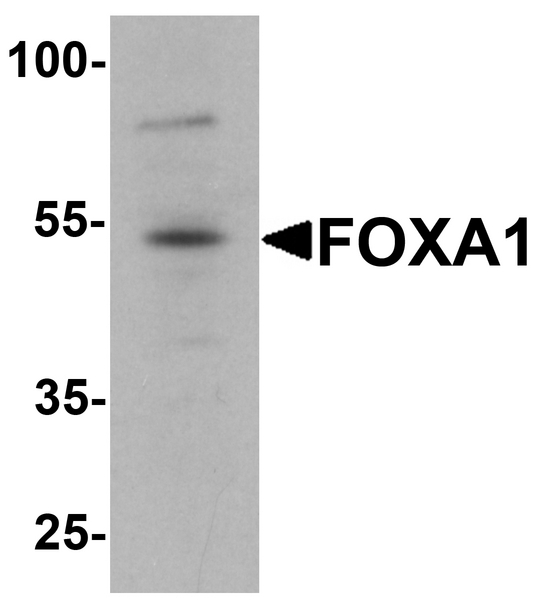 FOXA1 Antibody - Western blot analysis of FOXA1 in 293 cell lysate with FOXA1 antibody at 1 ug/ml