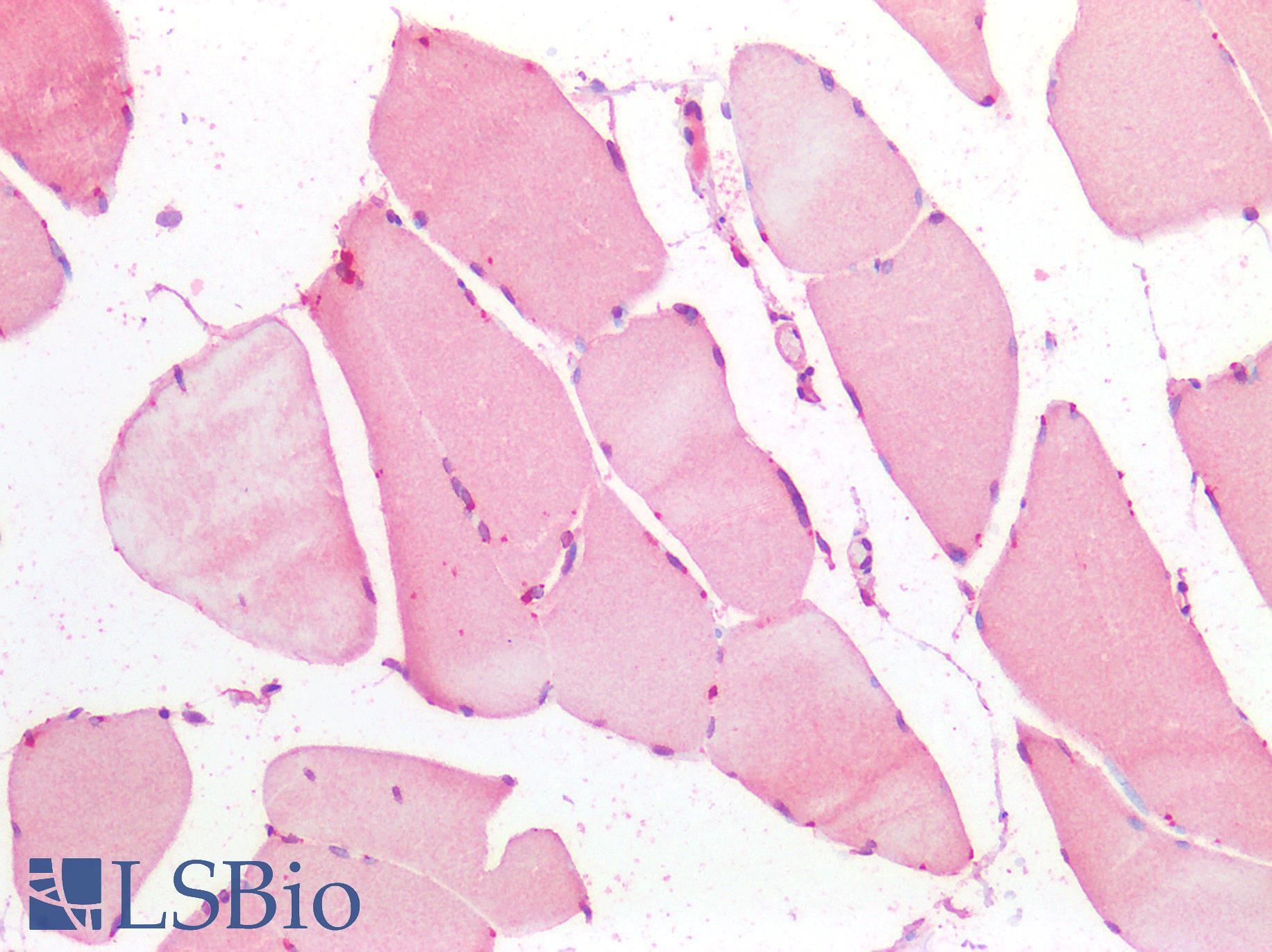 FOXC1 Antibody - Human Skeletal Muscle: Formalin-Fixed, Paraffin-Embedded (FFPE)