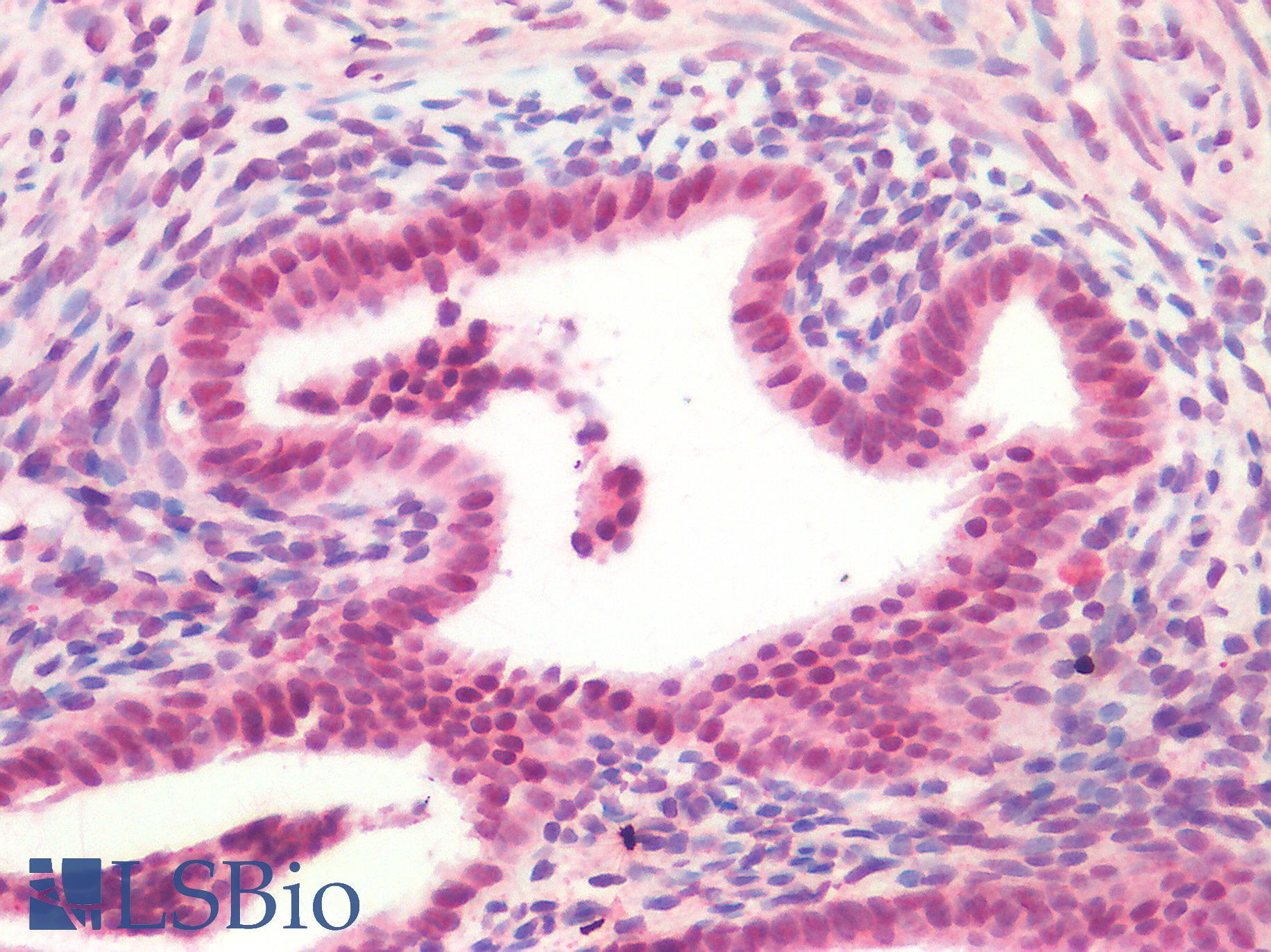FOXC1 Antibody - Human Uterus: Formalin-Fixed, Paraffin-Embedded (FFPE)