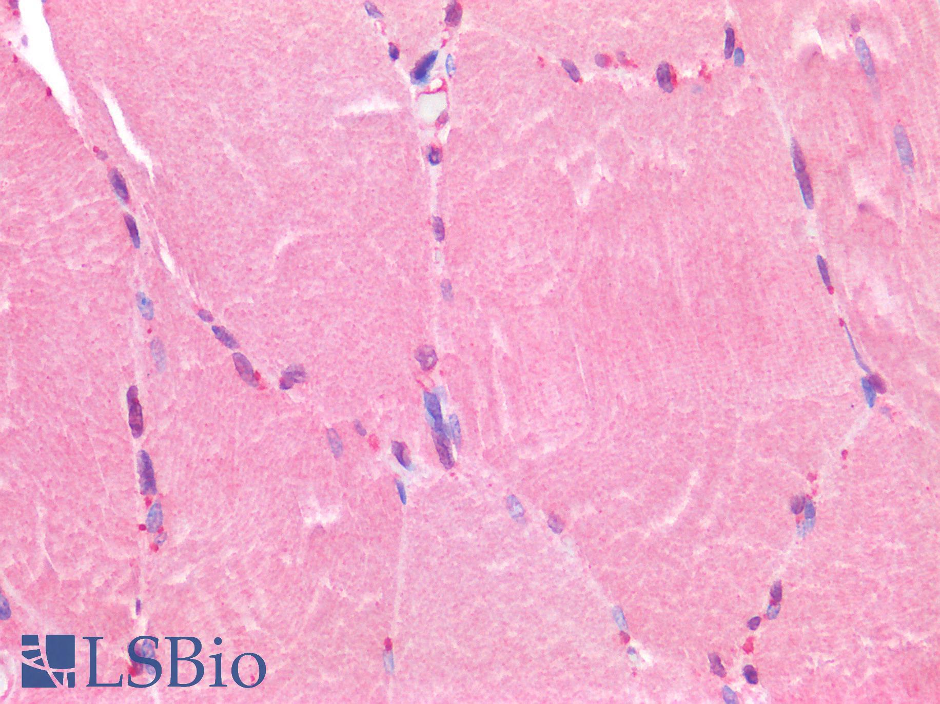 FOXC1 Antibody - Human Skeletal Muscle: Formalin-Fixed, Paraffin-Embedded (FFPE)