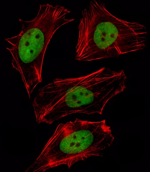 FOXD1 Antibody - Fluorescent image of B-3 cell stained with FOXD1 Antibody. B-3 cells were fixed with 4% PFA (20 min), permeabilized with Triton X-100 (0.1%, 10 min), then incubated with FOXD1 primary antibody (1:25, 1 h at 37°C). For secondary antibody, Alexa Fluor 488 conjugated donkey anti-rabbit antibody (green) was used (1:400, 50 min at 37°C). Cytoplasmic actin was counterstained with Alexa Fluor 555 (red) conjugated Phalloidin (7units/ml, 1 h at 37°C). FOXD1 immunoreactivity is localized to Nucleus significantly.