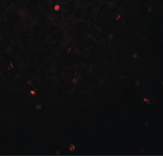 FOXH1 Antibody - Immunofluorescence of FOXH1 in human liver tissue with FOXH1 antibody at 20 ug/ml.
