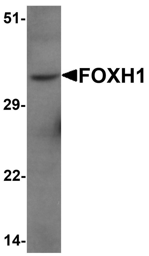 FOXH1 Antibody - Western blot analysis of FOXH1 in human liver tissue lysate with FOXH1 antibody at 1 ug/ml.
