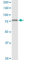 FOXK2 / ILF Antibody - FOXK2 monoclonal antibody (M04), clone 4A11. Western Blot analysis of FOXK2 expression in MCF-7.