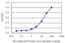 FOXK2 / ILF Antibody - Detection limit for recombinant GST tagged FOXK2 is 0.3 ng/ml as a capture antibody.