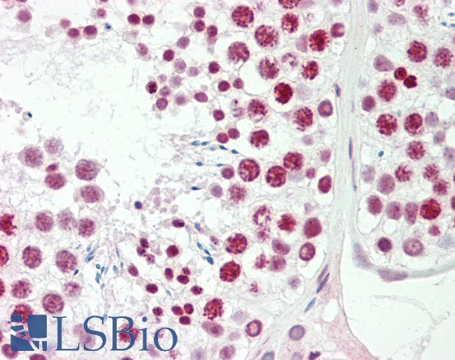 FOXL1 Antibody - Anti-FOXL1 antibody IHC staining of human testis. Immunohistochemistry of formalin-fixed, paraffin-embedded tissue after heat-induced antigen retrieval. Antibody dilution 1:100.