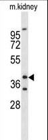 FOXL1 Antibody - Western blot of FOXL1 Antibody in mouse kidney tissue lysates (35 ug/lane). FOXL1 (arrow) was detected using the purified antibody.