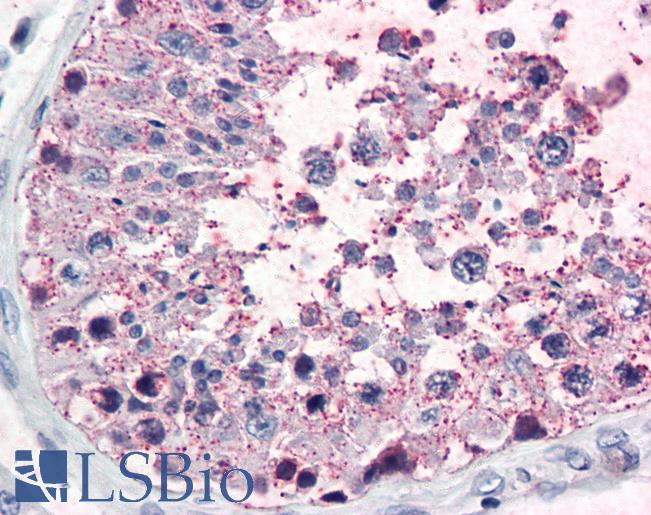 FOXL1 Antibody - Anti-FOXL1 antibody IHC of human testis. Immunohistochemistry of formalin-fixed, paraffin-embedded tissue after heat-induced antigen retrieval. Antibody concentration 10 ug/ml.