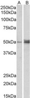 FOXL2 Antibody - Goat Anti-FOXL2 / BPES Antibody (1µg/ml) staining of Human (A) and Mouse (B) Ovary lysate (35µg protein in RIPA buffer). Detected by chemiluminescencence.