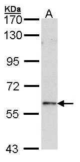 FOXN1 Antibody - Sample (30 ug of whole cell lysate). A: Raji. 7.5% SDS PAGE. FOXN1 antibody diluted at 1:1000. 