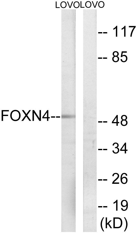FOXN4 Antibody - Western blot analysis of lysates from LOVO cells, using FOXN4 Antibody. The lane on the right is blocked with the synthesized peptide.