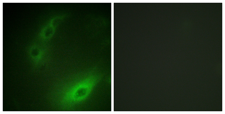 FOXO1 / FKHR Antibody - Immunofluorescence analysis of HUVEC cells, using FOXO1A Antibody. The picture on the right is blocked with the synthesized peptide.