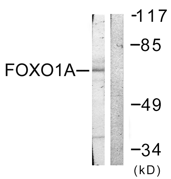 FOXO1 / FKHR Antibody - Western blot analysis of lysates from HeLa cells, treated with Serum 20% 15', using FOXO1A Antibody. The lane on the right is blocked with the synthesized peptide.